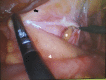 Figure 3:
