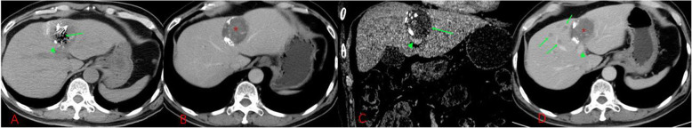 Fig. 4