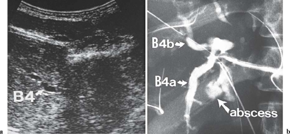 Fig. 1a,b