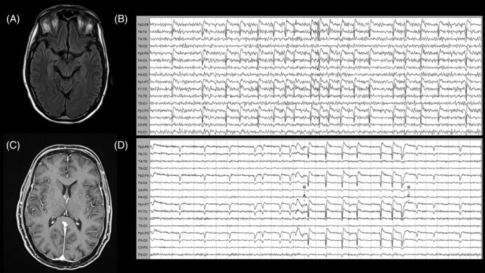 FIGURE 1