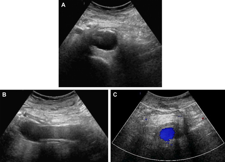 Fig. 11