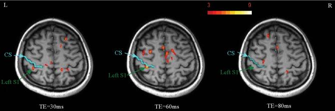 FIG. 7