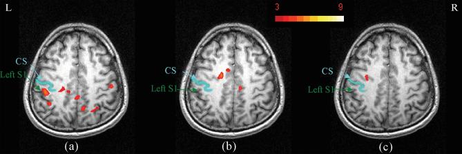 FIG. 6