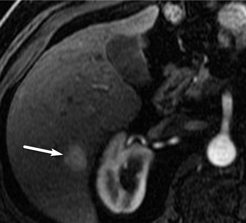 Figure 10b.