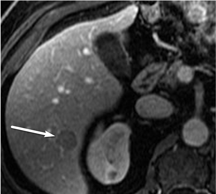 Figure 10c.