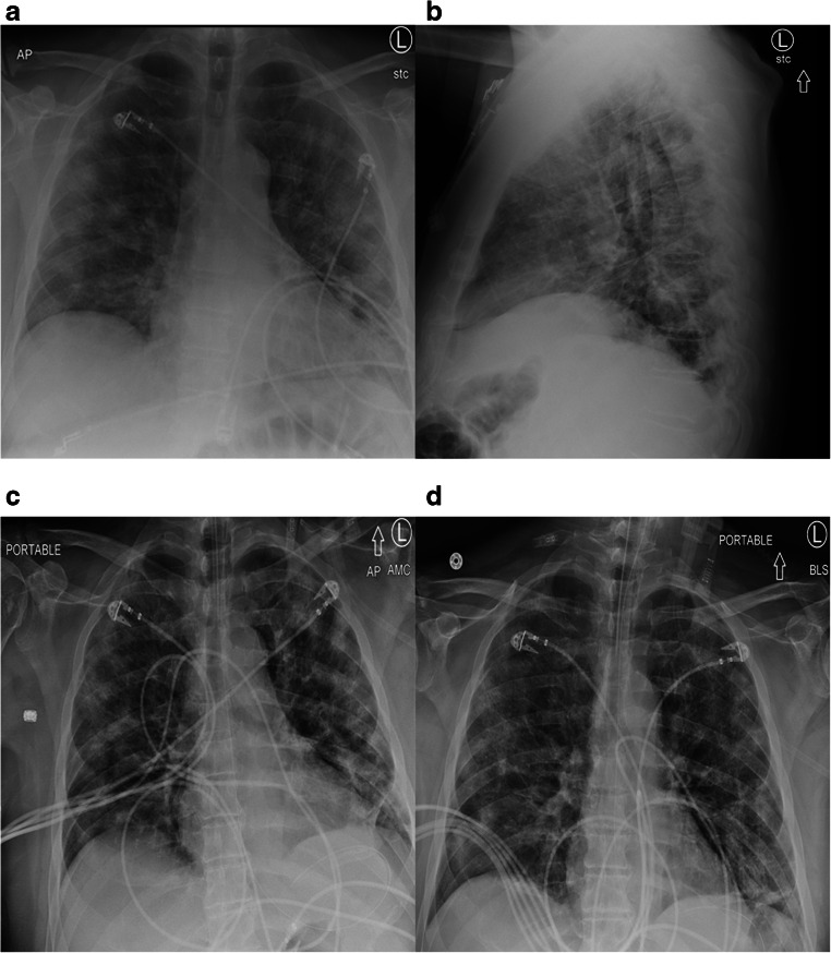 Fig. 2