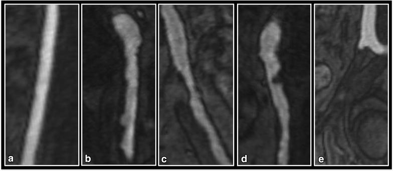 Fig. 2