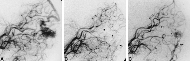 fig 2.