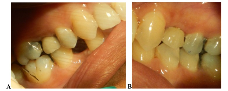 Fig. (5)