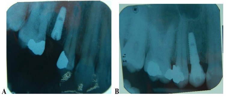 Fig. (1)