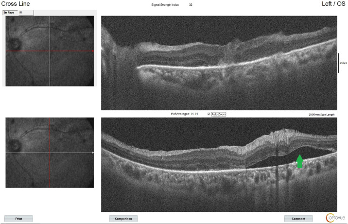 Figure 6