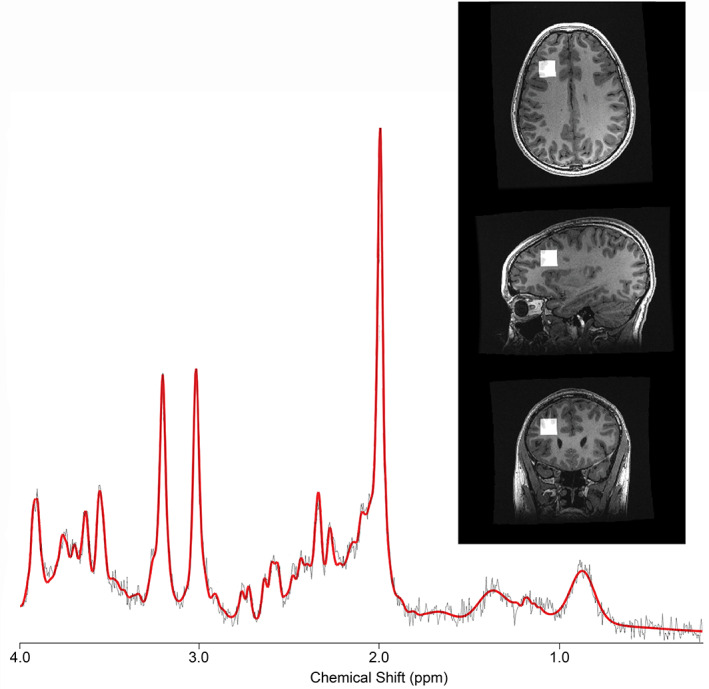 FIGURE 1