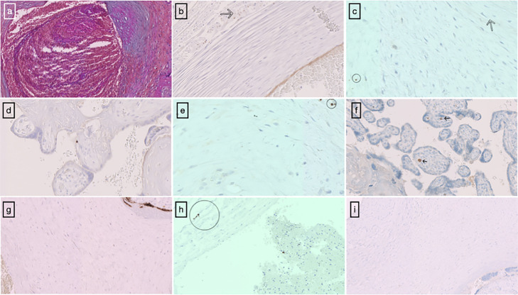 Fig. 2: