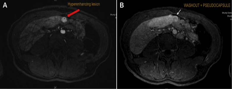 Figure 2