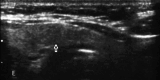 Figure 1E