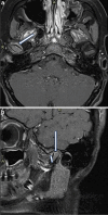 Fig. 9