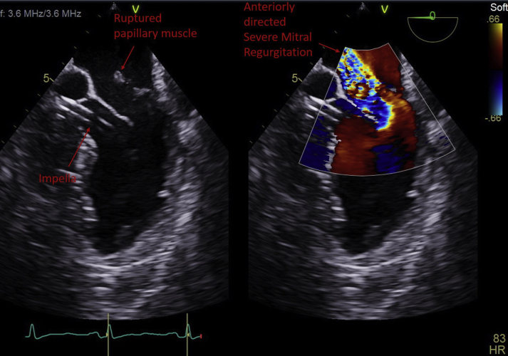 Figure 3