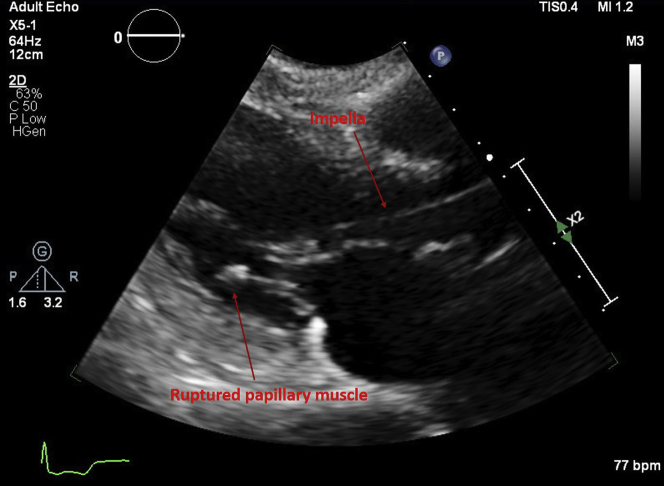 Figure 1