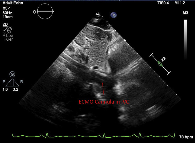 Figure 2