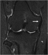 Fig. 11
