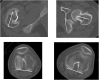 Fig. 6