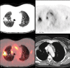 Figure 21