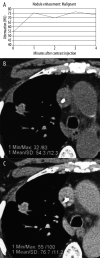 Figure 17