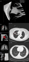 Figure 18