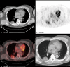 Figure 24