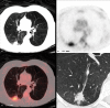 Figure 22