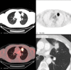 Figure 20