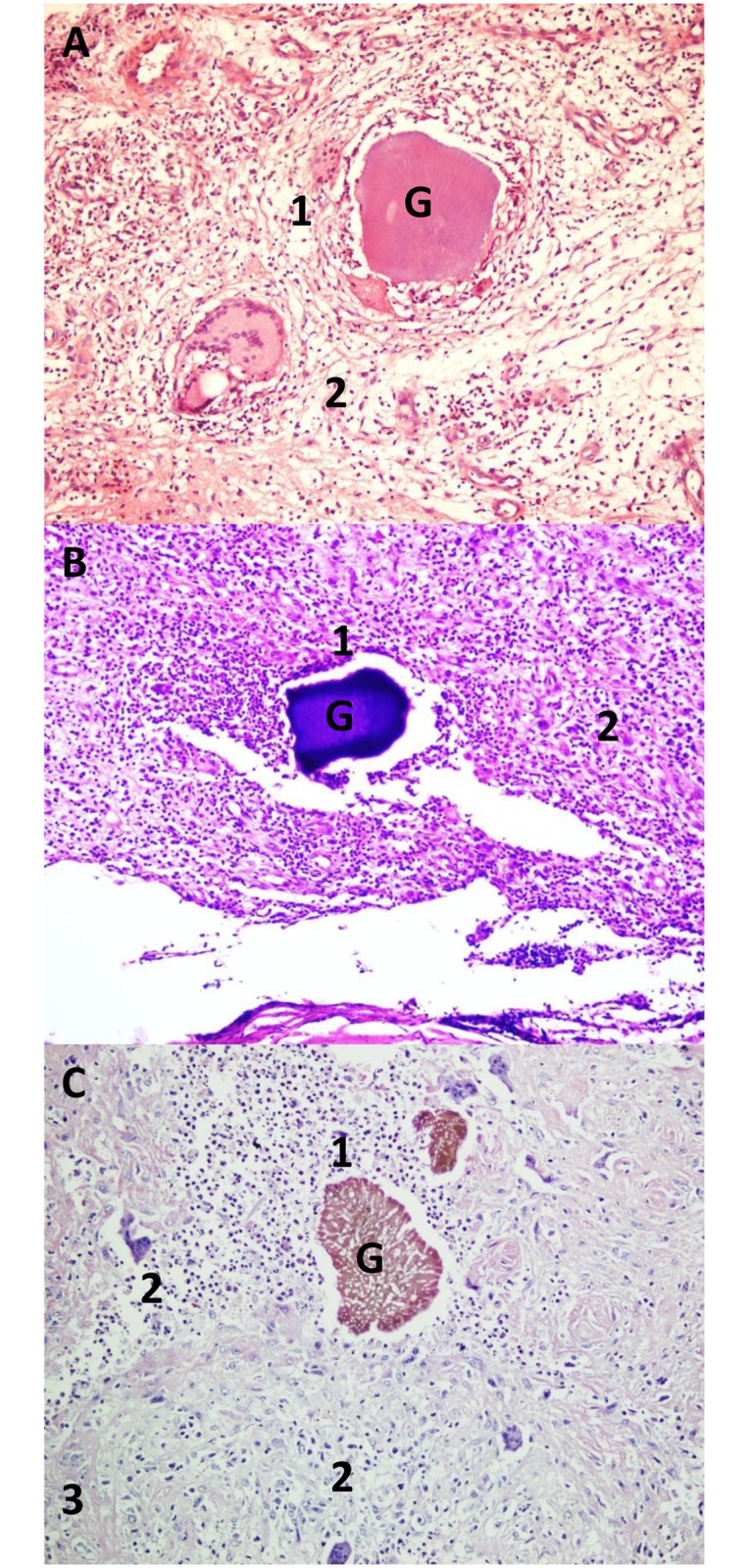 Fig 1