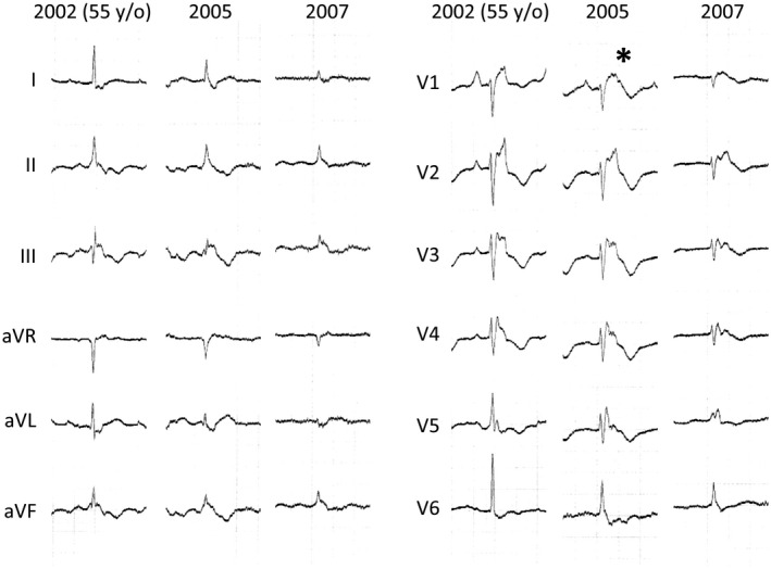 FIGURE 3