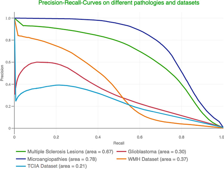 Precision–recall curves for anomaly delineation. The models’ performance in segmenting multiple sclerosis lesions, glioblastomas, microangiopathies, and pathologic conditions from two other public datasets quantified with a precision–recall curve. TCIA = glioma dataset from The Cancer Imaging Archive, WMH = dataset from the White Matter Hyperintensity segmentation challenge.