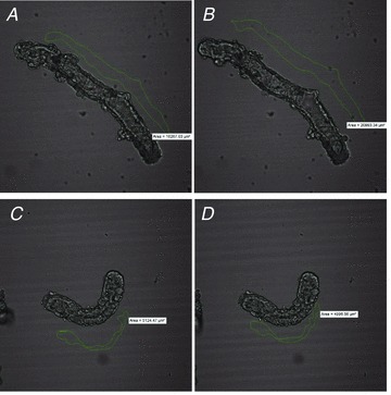 Figure 11