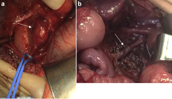 Fig 3