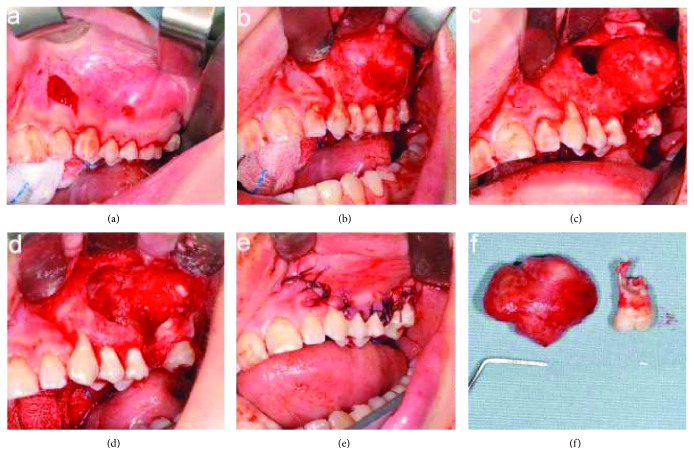 Figure 6