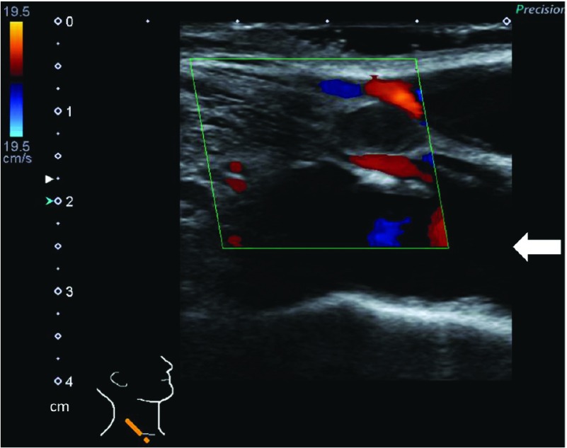 Fig. 3