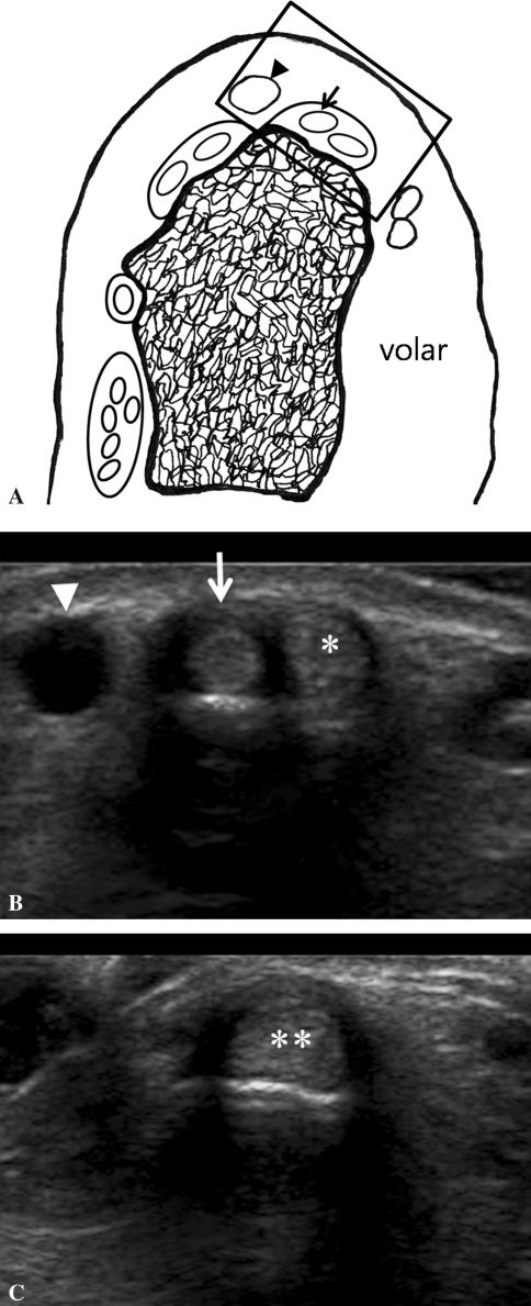 Fig. 1A–C