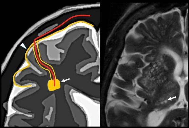 Fig 4.