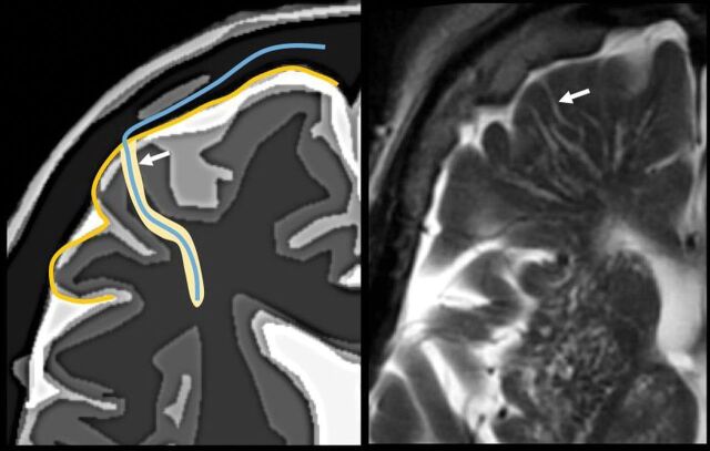 Fig 8.