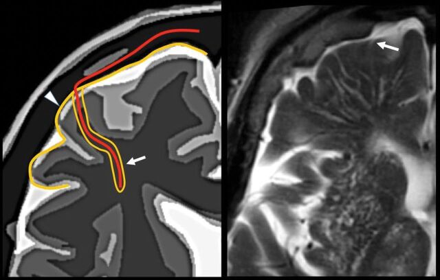 Fig 7.