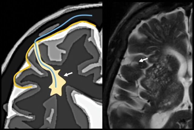 Fig 5.