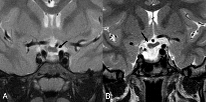 Fig 2.