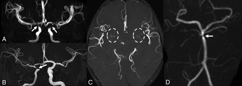 Fig 3.