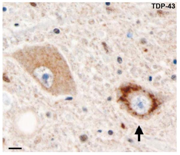 Fig. 10