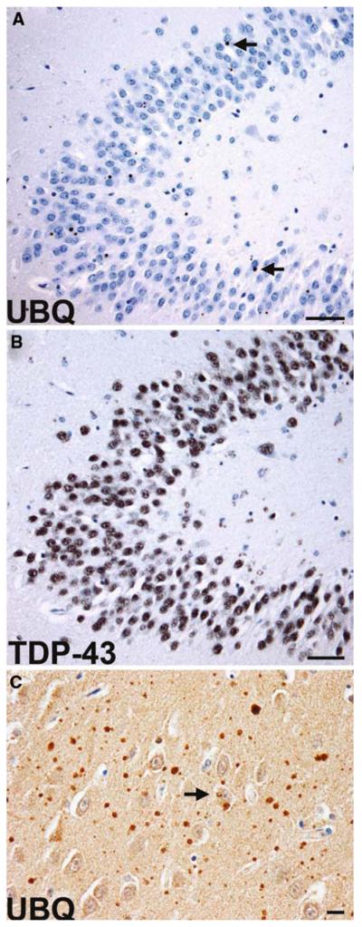 Fig. 12