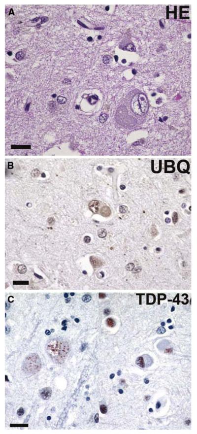 Fig. 13