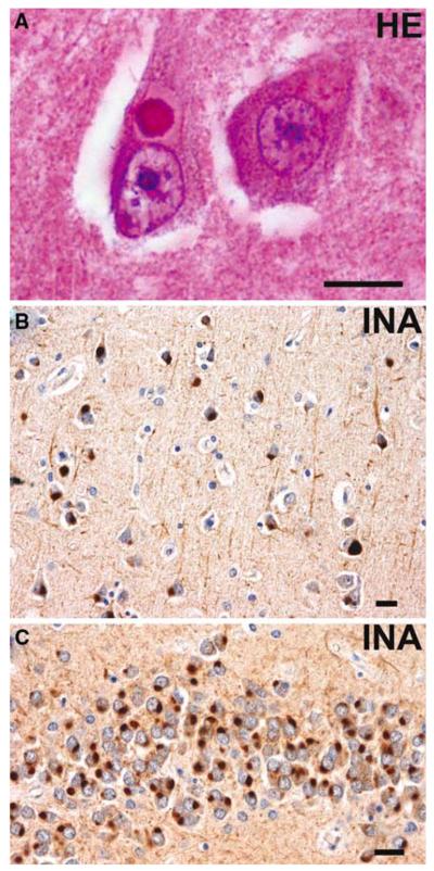 Fig. 14