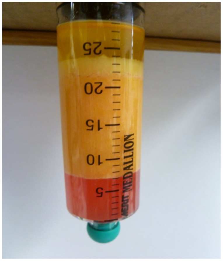Figure 14